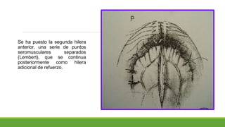 Se ha puesto la segunda hilera
anterior, una serie de puntos
seromusculares separados
(Lembert), que se continua
posteriormente como hilera
adicional de refuerzo.
 