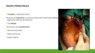 PASOS PRINCIPALES
Incisión a nivel de la lesión
Después de exponerla, se colocan pinzas por arriba y por debajo del
segmento enfermo de intestino
Se extirpa
Se practica una anastomosis:
termino-terminal
latero terminal
latero lateral
 