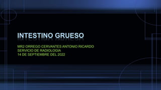 INTESTINO GRUESO
MR2 ORREGO CERVANTES ANTONIO RICARDO
SERVICIO DE RADIOLOGIA
14 DE SEPTIEMBRE DEL 2022
 
