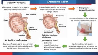 APENDICITIS AGUDA
Al aumentar la presión en el órgano,
se sobrepasa la presión venosa
Los capilares y vénulas son ocluidos
mientras continua la afluencia de
sangre arterial
• Ingurgitación
• Congestión vascular.
Proceso inflamatorio afecta la serosa
del apéndice y peritoneo parietal
La alteración de la irrigación
sanguínea ocasiona que la mucosa sea
más susceptible a invasión bacteriana
A medida que ocurre
• Distensión
• Invasión bacteriana
• Afectación de los vasos
• Avance al infarto
Ocurre perforación, por lo general en el
borde antimesentérico inmediatamente
distal al punto de obstrucción
ETIOLOGÍA Y PATOGENIA
 