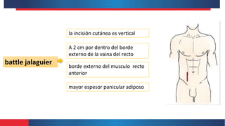 battle jalaguier
la incisión cutánea es vertical
borde externo del musculo recto
anterior
mayor espesor panicular adiposo
A 2 cm por dentro del borde
externo de la vaina del recto
 
