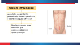 mediana infraumbilical
apendicitis con peritonitis
generalizada, absceso apendicular
o apendicitis aguda retrocecal
No diferenciar con otras
entidades que
ocasionen abdomen
agudo quirurgico
 