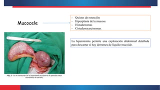 Mucocele
- Quistes de retención
- Hiperplasia de la mucosa
- Histadenomas
- Cistadenocarcinomas.
La laparotomía permite una exploración abdominal detallada
para descartar si hay derrames de líquido mucoide.
 