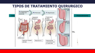 TIPOS DE TRATAMIENTO QUIRURGICO
RESECCIONES
Colectomía Parcial Colectomía Subtotal Protocolectomía
 