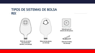 TIPOS DE SISTEMAS DE BOLSA
RECOLECTORA
 