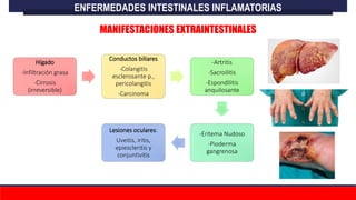 ENFERMEDADES INTESTINALES INFLAMATORIAS
MANIFESTACIONES EXTRAINTESTINALES
Hígado
-Infiltración grasa
-Cirrosis
(irreversible)
Conductos biliares
-Colangitis
esclerosante p.,
pericolangitis
-Carcinoma
-Artritis
-Sacroilitis
-Espondilitis
anquilosante
-Eritema Nudoso
-Pioderma
gangrenosa
Lesiones oculares:
Uveitis, iritis,
epiescleritis y
conjuntivitis
 