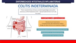 Tiene características clínicas y anatomopatológicas de colitis
ulcerosa y enfermedad de Crohn. Aproximadamente el 15 % de
los casos.
Colectomía abdominal total con ileostomía terminal
Reconstrucción anal con bolsa ileal
Proctectomía con ileostomía terminal
ENFERMEDADES INTESTINALES INFLAMATORIAS
INDICACIONES QUIRÚRGICAS
-Resistencia al tratamiento
-Complicaciones del tratamiento médico
-Riesgo de desarrollo de una neoplasia maligna.
 