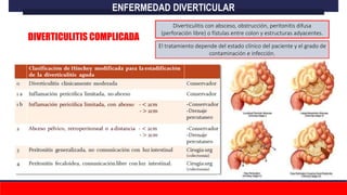 Diverticulitis con absceso, obstrucción, peritonitis difusa
(perforación libre) o fístulas entre colon y estructuras adyacentes.
El tratamiento depende del estado clínico del paciente y el grado de
contaminación e infección.
ENFERMEDAD DIVERTICULAR
DIVERTICULITIS COMPLICADA
 