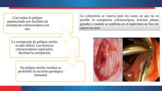 Casi todos lo pólipos
pedunculads son factibles de
extirpación colonoscópica con
asa.
La extirpación de pólipos sésiles
es más difícil. Las técnicas
colonoscópicas especiales,
facilitan la extirpación
En pólipos sésiles rectales es
preferible la escisión quirúrgica
transanal
La colectomía se reserva para los casos en que no es
posible la extirpación colonoscópica, lesiones planas
grandes o cuando se confirma en el espécimen un foco de
cáncer invasor.
 