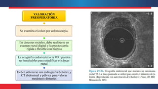 VALORACIÓN
PREOPERATORIA
Se examina el colon por colonoscopia.
En cánceres rectales, debe realizarse un
examen rectal digital y la proctoscopia
rígida o flexible con biopsia
La ecografía endorrectal o la MRI pueden
ser invaluables para estadificar el cáncer
rectal
Deben obtenerse una radiografía de tórax y
CT abdominal y pélvica para valorar
metástasis distantes
 