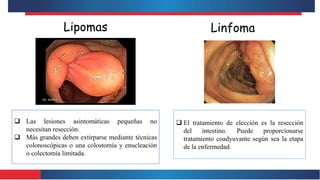 Lipomas
 Las lesiones asintomáticas pequeñas no
necesitan resección.
 Más grandes deben extirparse mediante técnicas
colonoscópicas o una colostomía y enucleación
o colectomía limitada.
Linfoma
 El tratamiento de elección es la resección
del intestino. Puede proporcionarse
tratamiento coadyuvante según sea la etapa
de la enfermedad.
 