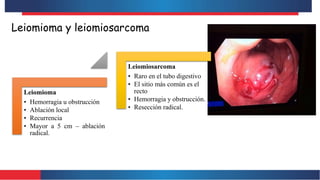 Leiomioma y leiomiosarcoma
Leiomioma
• Hemorragia u obstrucción
• Ablación local
• Recurrencia
• Mayor a 5 cm – ablación
radical.
Leiomiosarcoma
• Raro en el tubo digestivo
• El sitio más común es el
recto
• Hemorragia y obstrucción.
• Resección radical.
 