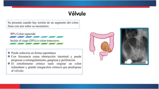 Vólvulo
Se presenta cuando hay torsión de un segmento del colon
lleno con aire sobre su mesenterio.
90% Colon sigmoide
Incluir el ciego (20%) o colon transverso
 Puede reducirse en forma espontánea
 Con frecuencia causa obstrucción intestinal y puede
progresar a estrangulamiento, gangrena y perforación.
 El estreñimiento crónico suele originar un colon
redundante y grande (megacolon crónico) que predispone
al vólvulo.
 