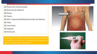  Obstrucción intestinal aguda.
 Distensión del abdomen
 Náusea
 Vómito
 Dolor e hipersensibilidad generalizados del abdomen
 Fiebre
 Leucocitosis
 Gangrena
 Perforación
En ocasiones los enfermos refieren antecedente prolongado
de síntomas de obstrucción y distensión intermitentes que
sugieren vólvulo crónico intermitente.
 
