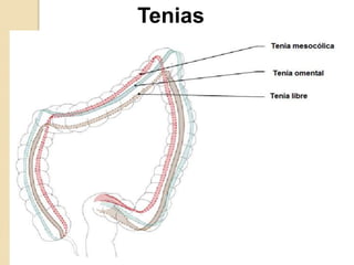 Tenias
 