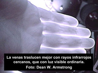 La venas traslucen mejor con rayos infrarrojos
cercanos, que con luz visible ordinaria.
Foto: Dean W. Armstrong
 