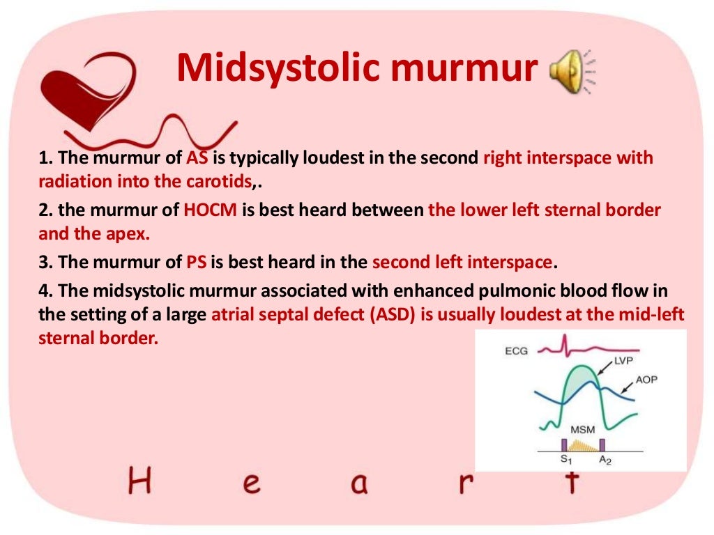 heart murmur (heart extra sounds)