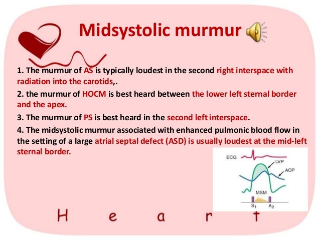 fever quickly decrease how to heart extra (heart murmur sounds) fever quickly decrease how to heart extra (heart murmur sounds)