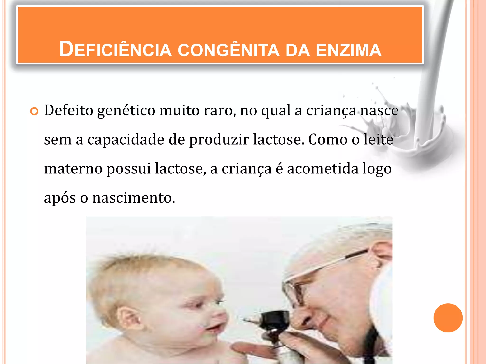  Defeito genético muito raro, no qual a criança nasce
sem a capacidade de produzir lactose. Como o leite
materno possui lactose, a criança é acometida logo
após o nascimento.
DEFICIÊNCIA CONGÊNITA DA ENZIMA
 