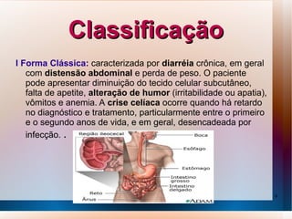Classificação
I Forma Clássica: caracterizada por diarréia crônica, em geral
   com distensão abdominal e perda de peso. O paciente
   pode apresentar diminuição do tecido celular subcutâneo,
   falta de apetite, alteração de humor (irritabilidade ou apatia),
   vômitos e anemia. A crise celíaca ocorre quando há retardo
   no diagnóstico e tratamento, particularmente entre o primeiro
   e o segundo anos de vida, e em geral, desencadeada por
   infecção. .




                                                                      9
 