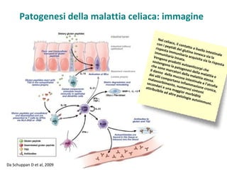 Patogenesi della malattia celiaca: immagine

                                             Nel ce
                                                     l
                                            con i iaco, il con
                                                   pe               t
                                           rispo ptidi del atto a live
                                                 st a i m         glutin           ll
                                          immu            muni             e inne o intestina
                                                 n               ta                sc                 le
                                         Veng itaria inna ria acquisi a sia la
                                                ono p            ta.             t a si a
                                        so st e         ro                                l a r i sp
                                               ngon dotti auto                                       o st a
                                                      o la p
                                       che s
                                              ono m           atoge anticorpi
                                      Il dan           a             ne               che
                                              no d rcatori de si della ma
                                     dei vi         el               ll                l
                                            lli com la mucosa a malattia attia e
                                     malas           p o rt a        intest           stessa
                                            s                n               in                .
                                    secon orbimento o infiamm ale e l’atr
                                           dari e           , num            azion            of ia
                                   attrib          u               e                e
                                          uibile na maggi rosi sinto cronica,
                                                  ad alt         or mo           mi
                                                          r e pa          r
                                                                tolog bidità
                                                                        ie aut
                                                                               oimm
                                                                                        uni.




Da Schuppan D et al, 2009
 