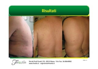 Risultati




                                                                    Pagina: 16
Via dei Prati Fiscali, 215 - 00141 Roma - Tel e Fax.: 06 88640002
www.frontis.it - segreteria@frontis.it
 