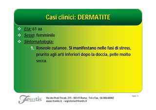 Casi clinici: DERMATITE
 Età: 61 aa
 Sesso: femminile
 Sintomatologia:
      1. Roseole cutanee. Si manifestano nelle fasi di stress,
                  cutanee
         prurito agli arti inferiori dopo la doccia, pelle molto
         secca.




                                                                                    Pagina: 17
                Via dei Prati Fiscali, 215 - 00141 Roma - Tel e Fax.: 06 88640002
                www.frontis.it - segreteria@frontis.it
 
