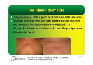 Casi clinici: dermatite
 Terapie eseguite: dieta e gocce per il ripristino della tolleranza
 Risultati: dopo due mesi di terapia con una dieta di rotazione
  che prevedeva l’esclusione del malto e derivati , si e’
  riscontrata la risoluzione delle roseole dolenti e pruriginose sul
  decolté e sul dorso.




                                                                                    Pagina: 19
                Via dei Prati Fiscali, 215 - 00141 Roma - Tel e Fax.: 06 88640002
                www.frontis.it - segreteria@frontis.it
 