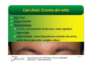Casi clinici: Eczema del volto
 Età: 41 aa
 Sesso: maschile
 Sintomatologia:
  1. Eczema, arrossamento ali del naso, cuoio capelluto,
     Eczema
     sopracciglia,
  2. colon irritabile, senso di pesantezza costante che arriva
     anche fino al ginocchio, caviglia e alluce.




                                                                                   Pagina: 23
               Via dei Prati Fiscali, 215 - 00141 Roma - Tel e Fax.: 06 88640002
               www.frontis.it - segreteria@frontis.it
 
