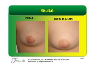 Risultati
PRIMA                                     DOPO 15 GIORNI




                                                                     Pagina: 29
 Via dei Prati Fiscali, 215 - 00141 Roma - Tel e Fax.: 06 88640002
 www.frontis.it - segreteria@frontis.it
 