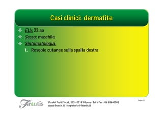 Casi clinici: dermatite
 Età: 23 aa
 Sesso: maschile
 Sintomatologia:
  1. Roseole cutanee sulla spalla destra




                                                                                  Pagina: 33
              Via dei Prati Fiscali, 215 - 00141 Roma - Tel e Fax.: 06 88640002
              www.frontis.it - segreteria@frontis.it
 