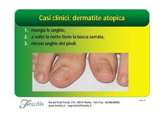 Casi clinici: dermatite atopica
1. mangia le unghie,
2. a volte la notte tiene la bocca serrata,
3. micosi unghie dei piedi.




                                                                                Pagina: 44
            Via dei Prati Fiscali, 215 - 00141 Roma - Tel e Fax.: 06 88640002
            www.frontis.it - segreteria@frontis.it
 