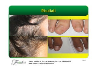 Risultati




                                                                    Pagina: 47
Via dei Prati Fiscali, 215 - 00141 Roma - Tel e Fax.: 06 88640002
www.frontis.it - segreteria@frontis.it
 