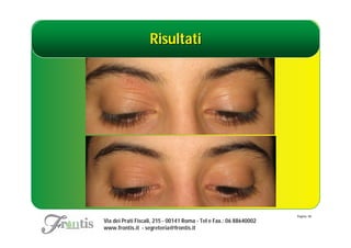 Risultati




                                                                    Pagina: 48
Via dei Prati Fiscali, 215 - 00141 Roma - Tel e Fax.: 06 88640002
www.frontis.it - segreteria@frontis.it
 