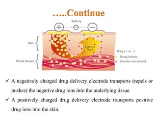  A negatively charged drug delivery electrode transports (repels or
pushes) the negative drug ions into the underlying tissue
 A positively charged drug delivery electrode transports positive
drug ions into the skin.
 