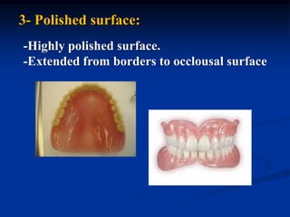 3- Polished surface:
-Highly polished surface.
-Extended from borders to occlousal surface
 