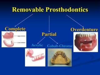 Removable Prosthodontics

Complete                        Overdenture
                 Partial

           Acrylic   Cobalt-Chrome
 