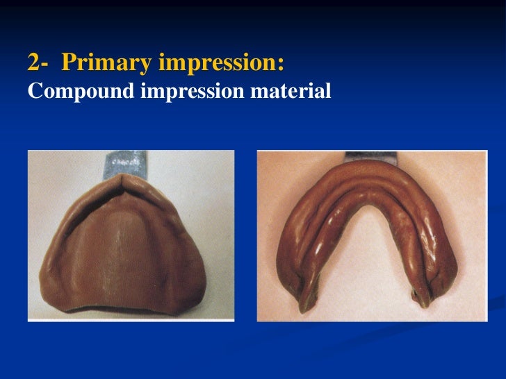 Introduction to Removable Prosthesis