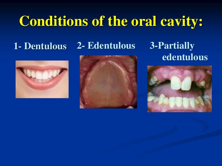 Introduction to Removable Prosthesis
