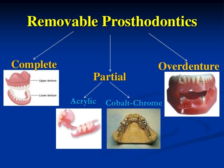 Introduction to Removable Prosthesis