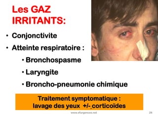 Les GAZ
IRRITANTS:
• Conjonctivite
• Atteinte respiratoire :
• Bronchospasme
• Laryngite
• Broncho-pneumonie chimique
www.efurgences.net 28
Traitement symptomatique :
lavage des yeux +/- corticoïdes
 