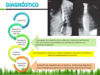 Anamnesis
Muestra de
un producto
ingerido
Radiografía
simple tórax-
abdomen
Analítica
sanguínea
Endoscopia
digestiva
Adolfo Bautista Casasnovas y Federico Argüelles Martín. Ingesta de cáusticos. Adolfo Bautista Casasnovas y Federico Argüelles Martín. Ingesta de cáusticos.
Sospecha de ingestión de un cáustico, endoscopia digestiva,
único método que permite un diagnóstico exacto de la lesión.
Para comprobar si existe una acidosis metabólica, leucocitosis, hemólisis o
signos de coagulopatía por consumo
- Fase aguda: Rx simple de tórax y abdomen ( descartar perforación)
-TAC con contraste oral (método mas sensible para detectar una
perforación incipiente).
 
