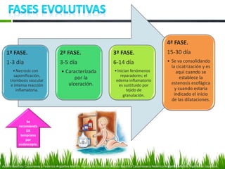 1ª FASE.
1-3 día
•Necrosis con
saponificación,
trombosis vascular
e intensa reacción
inflamatoria.
2ª FASE.
3-5 día
• Caracterizada
por la
ulceración.
3ª FASE.
6-14 día
•Inician fenómenos
reparadores; el
edema inflamatorio
es sustituido por
tejido de
granulación.
4ª FASE.
15-30 día
• Se va consolidando
la cicatrización y es
aquí cuando se
establece la
estenosis esofágica
y cuando estaría
indicado el inicio
de las dilataciones.
Adolfo Bautista Casasnovas y Federico Argüelles Martín. Ingesta de cáusticos. Adolfo Bautista Casasnovas y Federico Argüelles Martín. Ingesta de cáusticos.
Se
recomienda
DX
temprano
por
endoscopia.
 