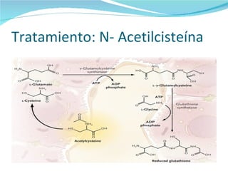 Tratamiento: N- Acetilcisteína  
