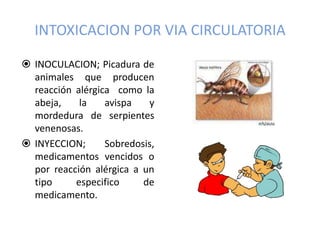 INTOXICACION POR VIA CIRCULATORIA
 INOCULACION; Picadura de
animales que producen
reacción alérgica como la
abeja, la avi...
