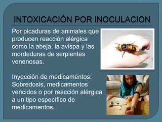  Por picaduras de animales que
producen reacción alérgica
como la abeja, la avispa y las
mordeduras de serpientes
venenosas.
 Inyección de medicamentos:
Sobredosis, medicamentos
vencidos o por reacción alérgica
a un tipo específico de
medicamentos.
 