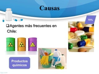 Causas
Agentes más frecuentes en
Chile:
70%
Productos
químicos
 
