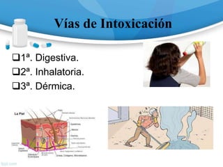 Vías de Intoxicación
1ª. Digestiva.
2ª. Inhalatoria.
3ª. Dérmica.
 