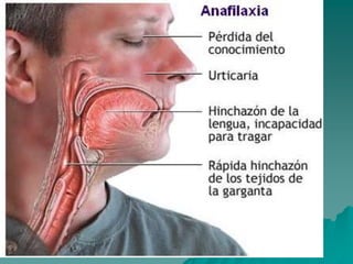 INTOXICACIONES IPM.ppt
