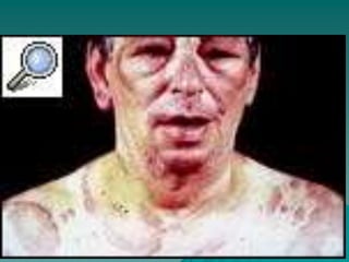 INTOXICACIONES IPM.ppt
